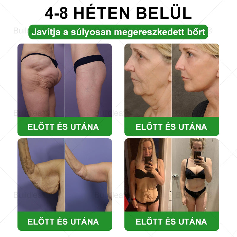 𝑴𝒂𝒈𝒚𝒂𝒓𝒐𝒓𝒔𝒛á𝒈𝒓ó𝒍 𝒔𝒛á𝒍𝒍í𝒕𝒗𝒂 | 𝑩𝒖𝒊𝒍𝒅𝑳𝒆𝒂𝒇® 𝑮𝑳𝑷-1 6 𝒂𝒛 1-𝒃𝒆𝒏 – 𝑺𝒛á𝒋ü𝒓𝒆𝒈𝒊 𝒆𝒈é𝒔𝒛𝒔é𝒈𝒎𝒆𝒈𝒐𝒍𝒅á𝒔 ✅ 𝑨𝒍𝒌𝒂𝒍𝒎𝒂𝒔 𝒆𝒍𝒉í𝒛á𝒔, 𝒔𝒛í𝒗- é𝒔 é𝒓𝒓𝒆𝒏𝒅𝒔𝒛𝒆𝒓𝒊 𝒆𝒈é𝒔𝒛𝒔é𝒈, 𝒄𝒖𝒌𝒐𝒓𝒃𝒆𝒕𝒆𝒈𝒔é𝒈, 𝒂𝒍𝒗á𝒔𝒊 𝒂𝒑𝒏𝒐𝒆, 𝒃é𝒍𝒓𝒆𝒏𝒅𝒔𝒛𝒆𝒓𝒊 𝒆𝒈é𝒔𝒛𝒔é𝒈, í𝒛ü𝒍𝒆𝒕𝒊 𝒑𝒓𝒐𝒃𝒍é𝒎á𝒌 é𝒔 𝒆𝒈𝒚é𝒃 𝒆𝒔𝒆𝒕𝒆𝒌 𝒕á𝒎𝒐𝒈𝒂𝒕á𝒔á𝒓𝒂.