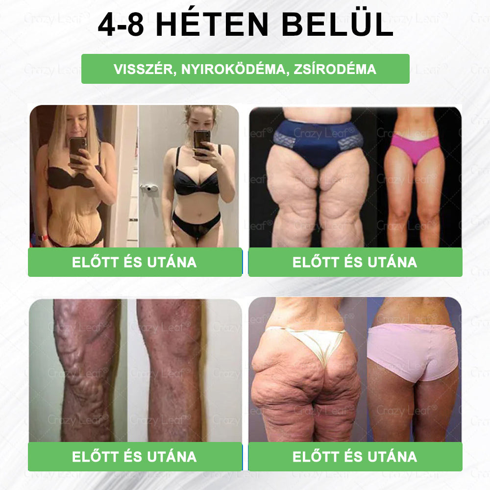 đ„Klinikailag igazolt | CrazyLeafÂź SMGT-GLP-1 Slim & Vitality â orĂĄlis megoldĂĄs makacs sĂșly, vĂ©rnyomĂĄs, cukor, zsĂrmĂĄj, ĂzĂŒleti fĂĄjdalom, fĂĄradtsĂĄg, alacsony energia Ă©s megereszkedett bĆr ellen. Jobb egĂ©szsĂ©g, több energia!