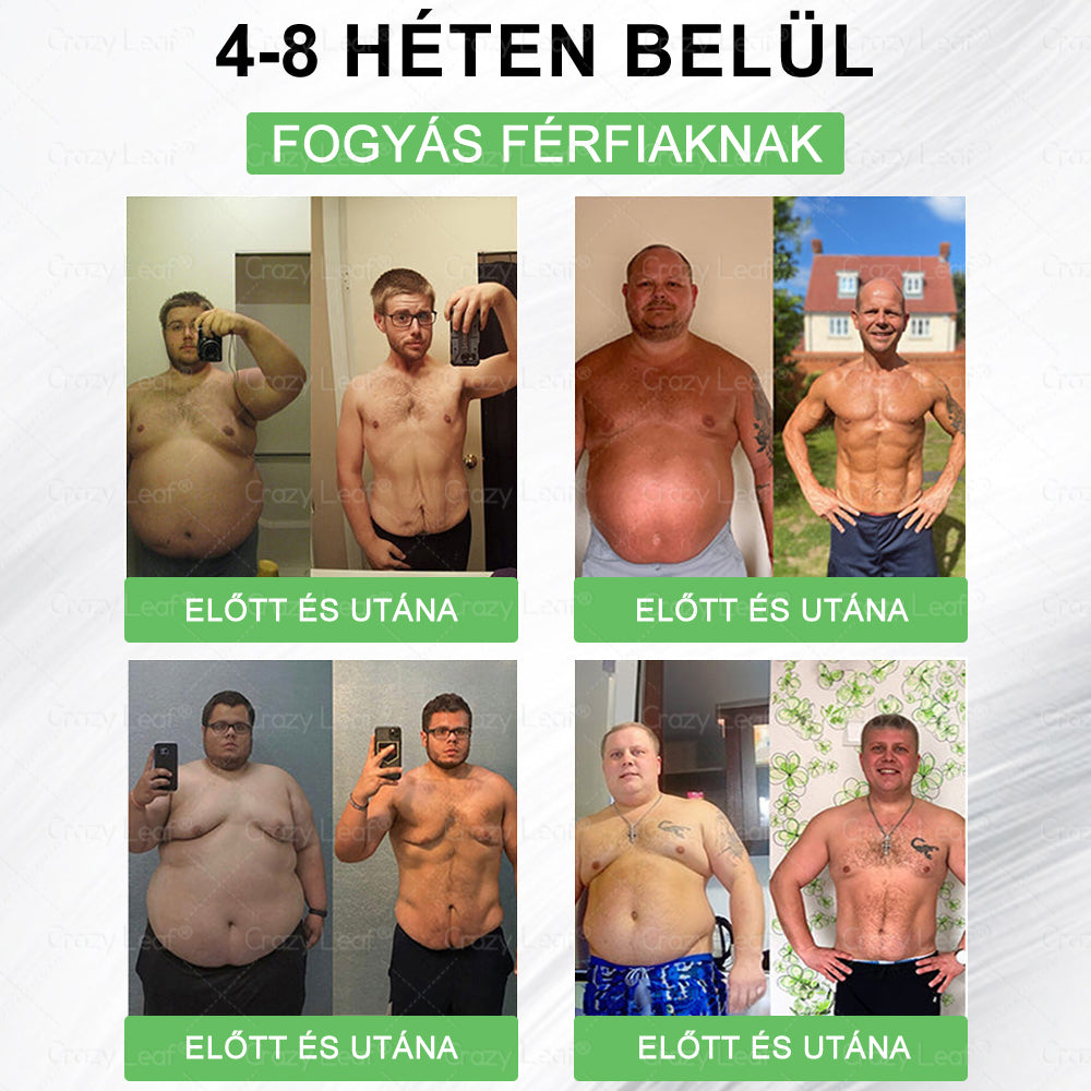 đ„Klinikailag igazolt | CrazyLeafÂź SMGT-GLP-1 Slim & Vitality â orĂĄlis megoldĂĄs makacs sĂșly, vĂ©rnyomĂĄs, cukor, zsĂrmĂĄj, ĂzĂŒleti fĂĄjdalom, fĂĄradtsĂĄg, alacsony energia Ă©s megereszkedett bĆr ellen. Jobb egĂ©szsĂ©g, több energia!