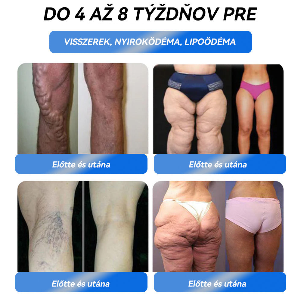 🎖️Már csak 5 doboz van! Használd ki most az extra 80% kedvezményt! Szerezd vissza az alakod és az egészséged! Ha most kihagyod ezt a lehetőséget, jövőre talán már késő lesz! 💥🔥