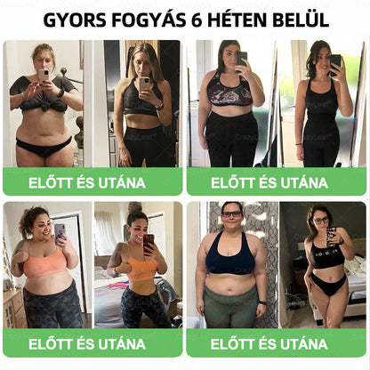 🏥Klinikailag igazolt | CrazyLeaf® SMGT-GLP-1 Slim & Vitality – orális megoldás makacs súly, vérnyomás, cukor, zsírmáj, ízületi fájdalom, fáradtság, alacsony energia és megereszkedett bőr ellen. Jobb egészség, több energia!