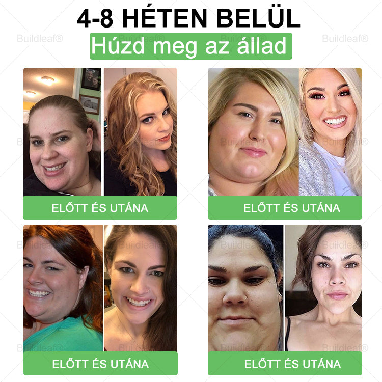 𝑴𝒂𝒈𝒚𝒂𝒓𝒐𝒓𝒔𝒛á𝒈𝒓ó𝒍 𝒔𝒛á𝒍𝒍í𝒕𝒗𝒂 | 𝑩𝒖𝒊𝒍𝒅𝑳𝒆𝒂𝒇® 𝑮𝑳𝑷-1 6 𝒂𝒛 1-𝒃𝒆𝒏 – 𝑺𝒛á𝒋ü𝒓𝒆𝒈𝒊 𝒆𝒈é𝒔𝒛𝒔é𝒈𝒎𝒆𝒈𝒐𝒍𝒅á𝒔 ✅ 𝑨𝒍𝒌𝒂𝒍𝒎𝒂𝒔 𝒆𝒍𝒉í𝒛á𝒔, 𝒔𝒛í𝒗- é𝒔 é𝒓𝒓𝒆𝒏𝒅𝒔𝒛𝒆𝒓𝒊 𝒆𝒈é𝒔𝒛𝒔é𝒈, 𝒄𝒖𝒌𝒐𝒓𝒃𝒆𝒕𝒆𝒈𝒔é𝒈, 𝒂𝒍𝒗á𝒔𝒊 𝒂𝒑𝒏𝒐𝒆, 𝒃é𝒍𝒓𝒆𝒏𝒅𝒔𝒛𝒆𝒓𝒊 𝒆𝒈é𝒔𝒛𝒔é𝒈, í𝒛ü𝒍𝒆𝒕𝒊 𝒑𝒓𝒐𝒃𝒍é𝒎á𝒌 é𝒔 𝒆𝒈𝒚é𝒃 𝒆𝒔𝒆𝒕𝒆𝒌 𝒕á𝒎𝒐𝒈𝒂𝒕á𝒔á𝒓𝒂.
