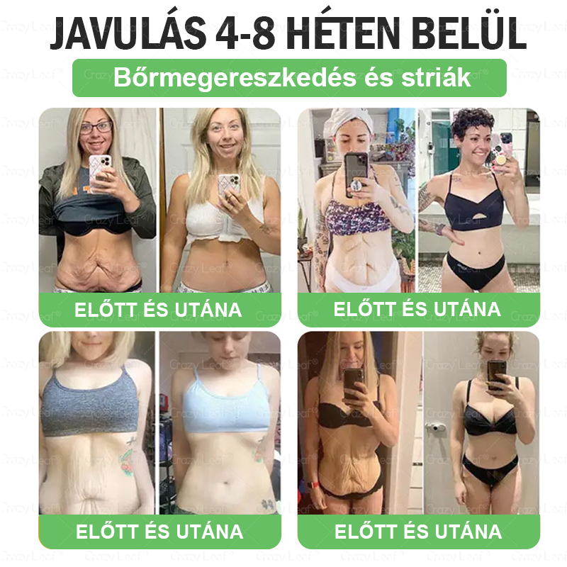 🏥Klinikailag igazolt | CrazyLeaf® SMGT-GLP-1 Slim & Vitality – orális megoldás makacs súly, vérnyomás, cukor, zsírmáj, ízületi fájdalom, fáradtság, alacsony energia és megereszkedett bőr ellen. Jobb egészség, több energia!