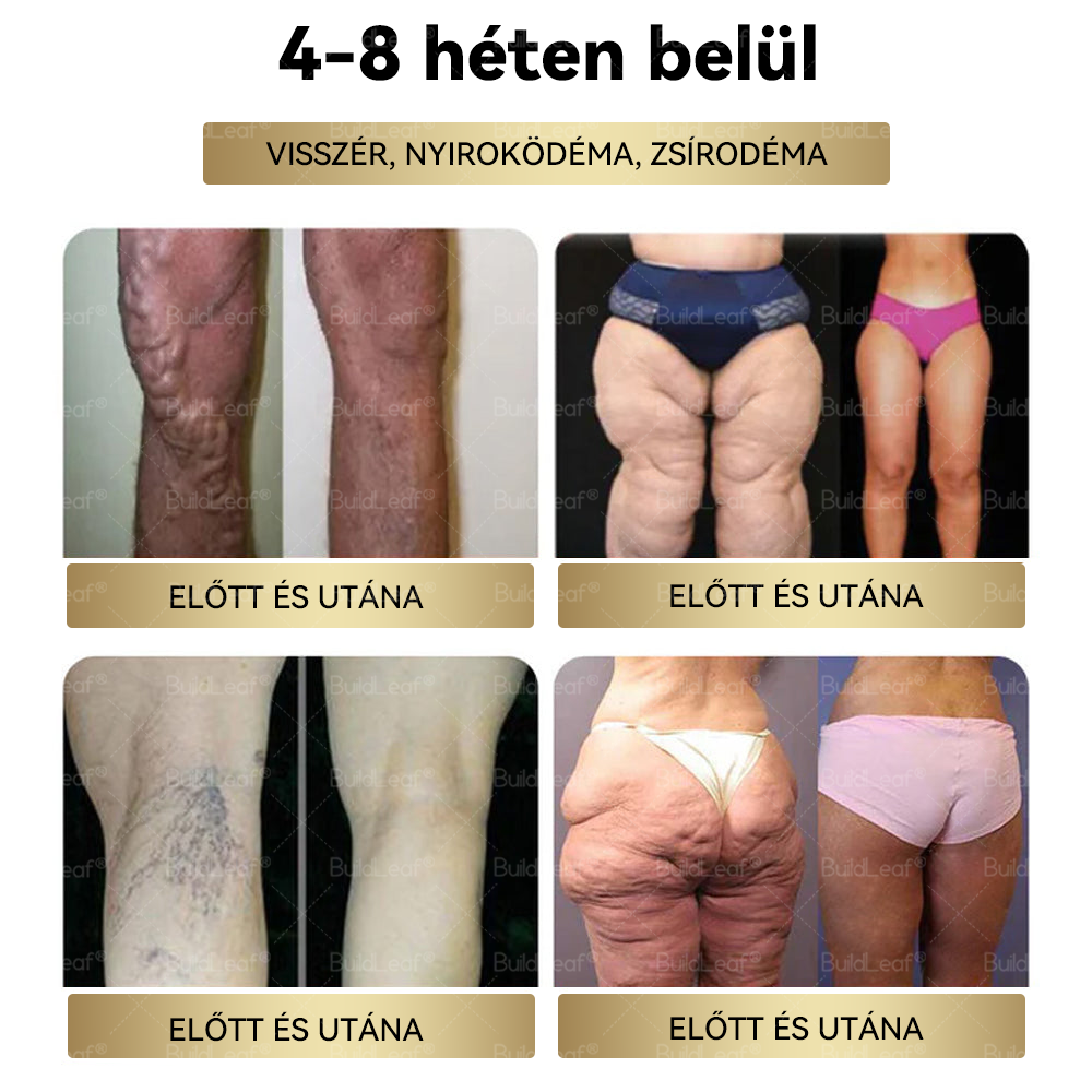 🎈Már csak 5 üveg maradt! További 50% kedvezmény! Szerezd vissza az alakod és egészséged! Ha most kihagyod ezt a lehetőséget, jövőre már lehet, hogy túl késő lesz! 💥🔥