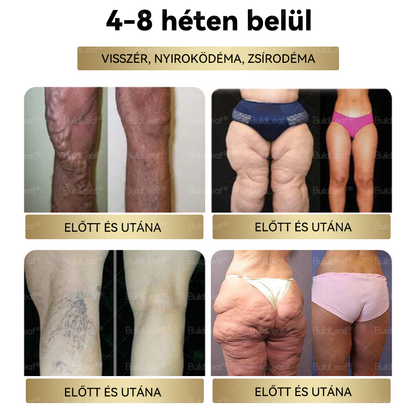🎈Már csak 5 üveg maradt! További 50% kedvezmény! Szerezd vissza az alakod és egészséged! Ha most kihagyod ezt a lehetőséget, jövőre már lehet, hogy túl késő lesz! 💥🔥
