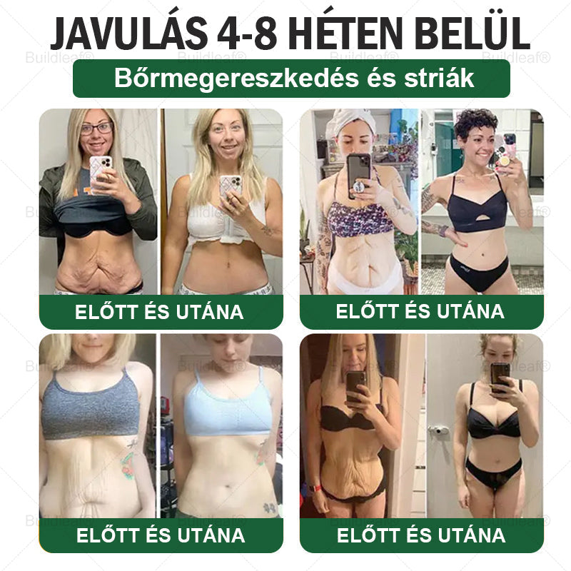 𝑴𝒂𝒈𝒚𝒂𝒓𝒐𝒓𝒔𝒛á𝒈𝒓ó𝒍 𝒔𝒛á𝒍𝒍í𝒕𝒗𝒂 | 𝑩𝒖𝒊𝒍𝒅𝑳𝒆𝒂𝒇® 𝑮𝑳𝑷-1 6 𝒂𝒛 1-𝒃𝒆𝒏 – 𝑺𝒛á𝒋ü𝒓𝒆𝒈𝒊 𝒆𝒈é𝒔𝒛𝒔é𝒈𝒎𝒆𝒈𝒐𝒍𝒅á𝒔 ✅ 𝑨𝒍𝒌𝒂𝒍𝒎𝒂𝒔 𝒆𝒍𝒉í𝒛á𝒔, 𝒔𝒛í𝒗- é𝒔 é𝒓𝒓𝒆𝒏𝒅𝒔𝒛𝒆𝒓𝒊 𝒆𝒈é𝒔𝒛𝒔é𝒈, 𝒄𝒖𝒌𝒐𝒓𝒃𝒆𝒕𝒆𝒈𝒔é𝒈, 𝒂𝒍𝒗á𝒔𝒊 𝒂𝒑𝒏𝒐𝒆, 𝒃é𝒍𝒓𝒆𝒏𝒅𝒔𝒛𝒆𝒓𝒊 𝒆𝒈é𝒔𝒛𝒔é𝒈, í𝒛ü𝒍𝒆𝒕𝒊 𝒑𝒓𝒐𝒃𝒍é𝒎á𝒌 é𝒔 𝒆𝒈𝒚é𝒃 𝒆𝒔𝒆𝒕𝒆𝒌 𝒕á𝒎𝒐𝒈𝒂𝒕á𝒔á𝒓𝒂.